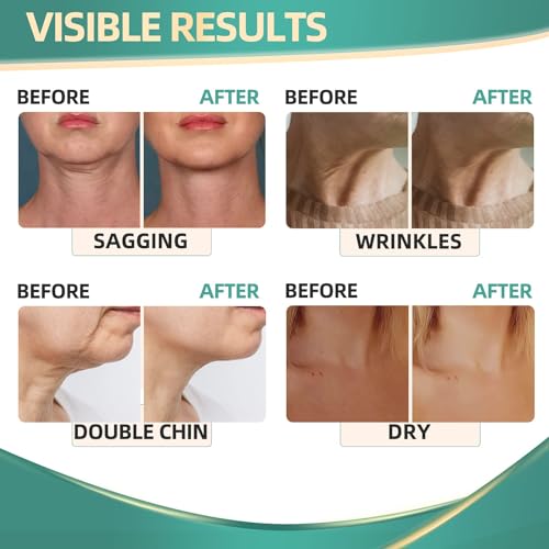 Neck Cream for Tightening Firming: Instant Face Lift Cream - Wrinkle Cream for Women RONKIEAu supplements