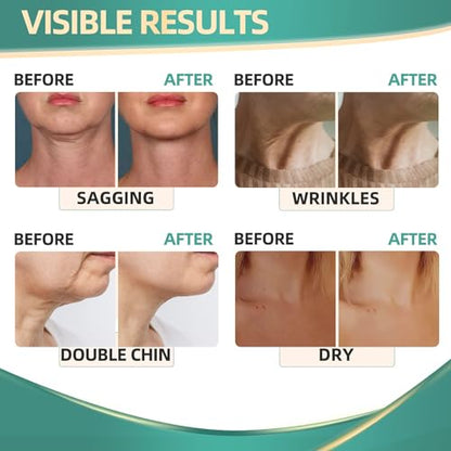 Neck Cream for Tightening Firming: Instant Face Lift Cream - Wrinkle Cream for Women RONKIEUS supplements