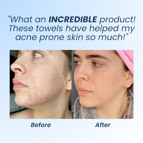 Clean Skin Club Clean Towels XL, Dermatologist Approved, 100% USDA CLEAN SKIN CLUBUS supplements