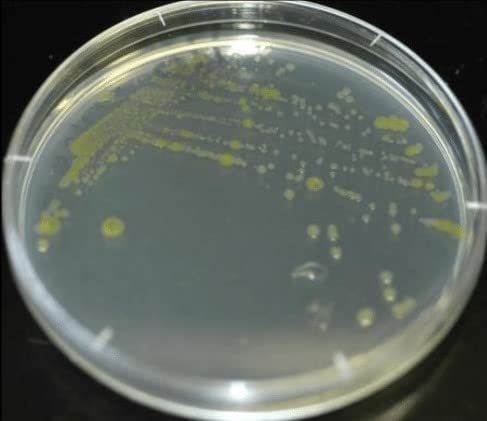 Diamante Scientific Essential Bacteria Kit. Pre-Poured Agar Plates & Swabs. Perfect for Kids. Great for Learning About Microbiology. STEM Education. Experiment Guide eBook Included! Diamante ScientificAu supplements