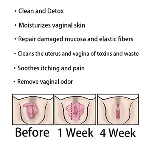 DASHENRAN Annie Care Natural Detox Viginal Capsules, Anniecare Instant Anti Itch Detox Slimming Products DASHENRANUS supplements