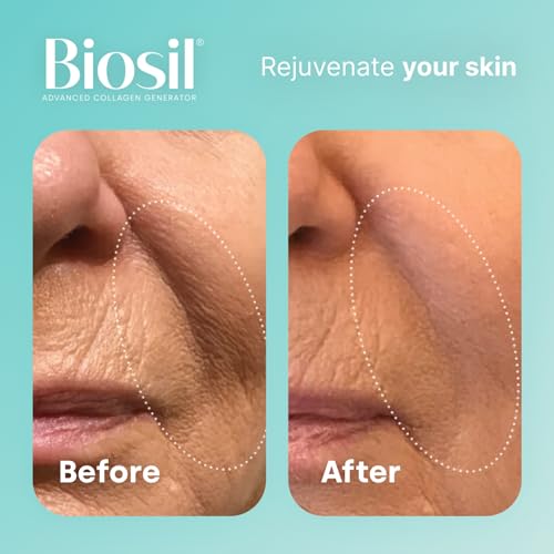 Biosil Collagen Generator - 120 Capsules - with Patented ch-OSA Complex - Generates & Protects Your Own Collagen BioSilAu supplements