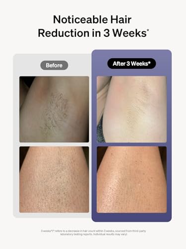 Ulike Laser Hair Removal for Women and Men, Air 3 IPL Hair Removal with Sapphire Ice-Cooling System UlikeAu supplements
