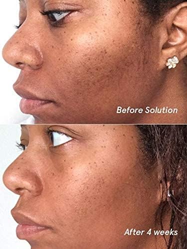 Glossier Solution exfoliating skin perfector 4.4 fl oz / 130 ml GlossierAu supplements