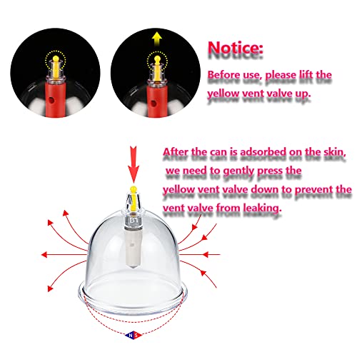 MYMM 12 Cupping Cups Sets Biomagnetic Traditional Professional Chinese Therapy Massage MYMMAu supplements