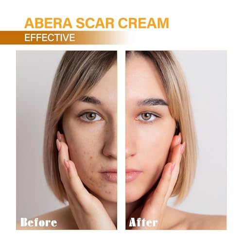 ABERA Scar Removal Cream for Women and Men - Rapid Repair of New Old Scars, Spots, Burns All Natural Treatment with Vitamin E, Alanine, Collagen (1 Box + 3 Eye Patch) ABERAAu supplements