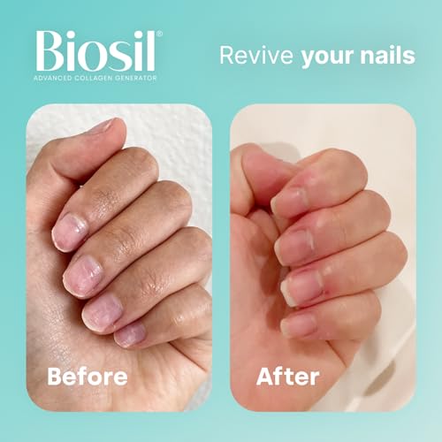 Biosil Collagen Generator - 60 Capsules - with Patented ch-OSA Complex - Generates & Protects Your Own Collagen BioSilAu supplements