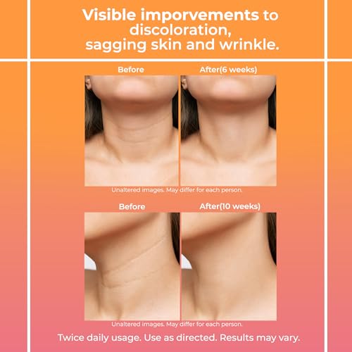 Neck Firming Cream for Women: Neck Cream - Neck Tightening Cream - Neck Creams LemcuhAu supplements