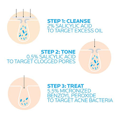 La Roche-Posay Effaclar Dermatological 3 Step Acne Treatment System La Roche-PosayUS supplements