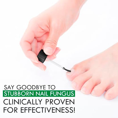 Viking Revolution Toenail Fungus Treatment Extra Strength with 1% Tolnaftate OTC Viking RevolutionUS supplements