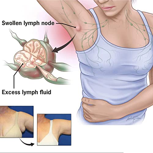 CSIYANJRY99 Lymph Purifying Ring Lymphatic Drainage Therapeutic Rings Set CSIYANJRY99Au supplements