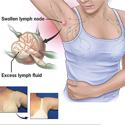 CSIYANJRY99 Lymph Purifying Ring Lymphatic Drainage Therapeutic Rings Set CSIYANJRY99US supplements