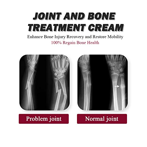 Joint Collagen Relieves Joint Soreness And Body Joint Care Collagen Get Thick Products GenericAu supplements
