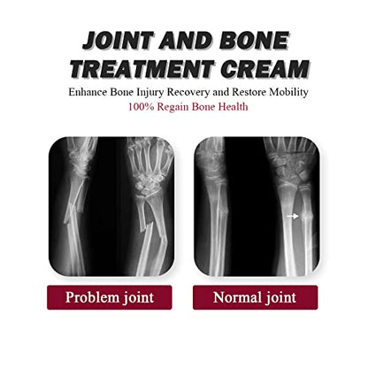 Joint Collagen Relieves Joint Soreness And Body Joint Care Collagen Get Thick Products GenericUS supplements