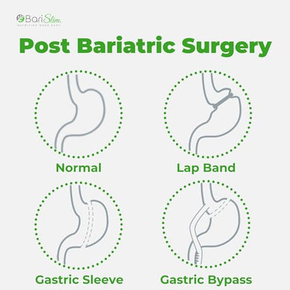 BariSlim Iron Plus Capsules - Formulated for Patients After Weight Loss Surgery Including BariSlimUS supplements