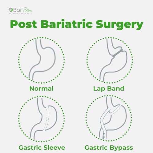 BariSlim Iron Plus Capsules - Formulated for Patients After Weight Loss Surgery Including BariSlimAu supplements