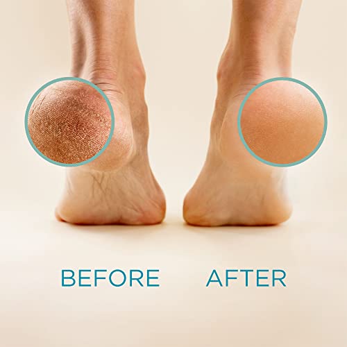 Lee Beauty Professional Callus Remover for Feet - 8 Oz, Original, Powerful Lee Beauty ProfessionalUS supplements