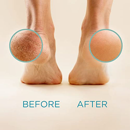 Lee Beauty Professional Callus Remover for Feet - 8 Oz, Original, Powerful Lee Beauty ProfessionalUS supplements