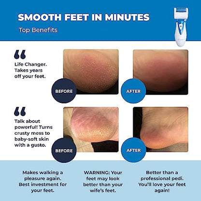 Electric Callus Remover: Own Harmony Professional Pedicure Tools Foot Own HarmonyUS supplements