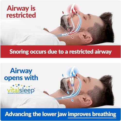 VitalSleep Anti-Snoring Mouthpiece, Adjustable Jaw Positioning Vital SleepUS supplements