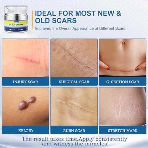 BORMSI Scar Cream,Active Silicone Dimethicone Scar Gel-Advanced BORMSIAu supplements