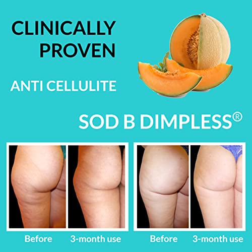 UpNourish Anti Cellulite Supplements - Varicose Veins Support, Restless Leg Relief UpNourishUS supplements