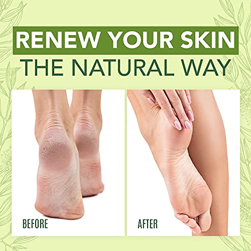 Tea Tree Oil Foot Cream For Dry Cracked Heels Repair - Natural Foot Cream For Dry Cracke USA NaturalsUS supplements