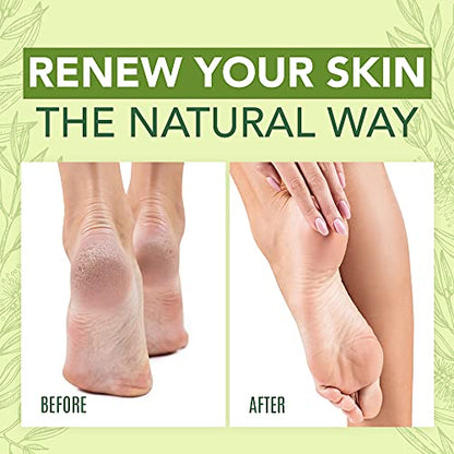 Tea Tree Oil Foot Cream For Dry Cracked Heels Repair - Natural Foot Cream For Dry Cracke USA NaturalsUS supplements