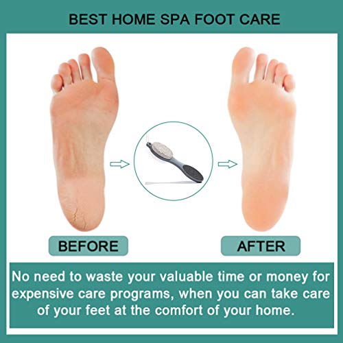 CAREHOOD Foot File Callus Remover - Multi Purpose 4 in 1 Feet Pedicure CAREHOODUS supplements
