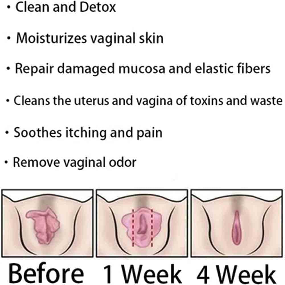 Natural Repair Vagianal Capsules, Anniecare Instant Anti-Itch Detox Slimming Products GDSAFSAu supplements