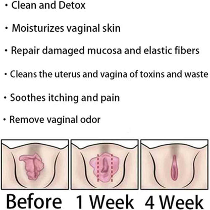 Natural Repair Vagianal Capsules, Anniecare Instant Anti-Itch Detox Slimming Products GDSAFSUS supplements