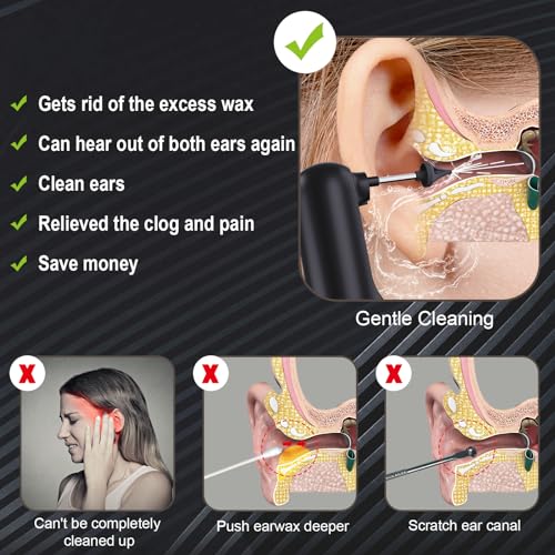 Upgraded Ear Wax Removal,Water Powered Ear Cleaner,Ear Cleaning Kit AlledgeAu supplements