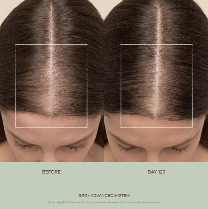 VEGAMOUR GRO+ Advanced Essentials Kit | Removes Buildup, Improves Hair Density, Reduces Shedding, Hydrates and Exfoliates the Scalp | For Severe Signs of Thinning | Color Safe, Vegan, Cruelty-Free VEGAMOURAu supplements