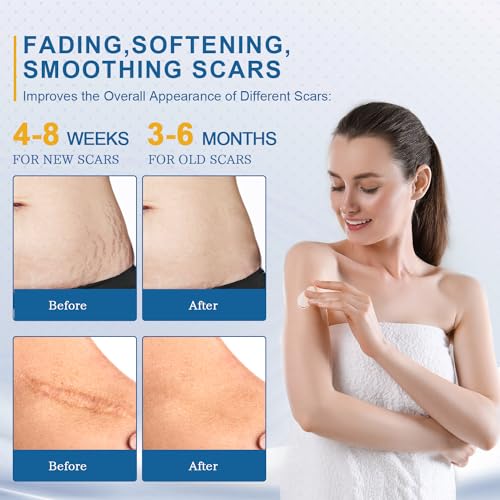 BORMSI Scar Cream,Active Silicone Dimethicone Scar Gel-Advanced BORMSIAu supplements