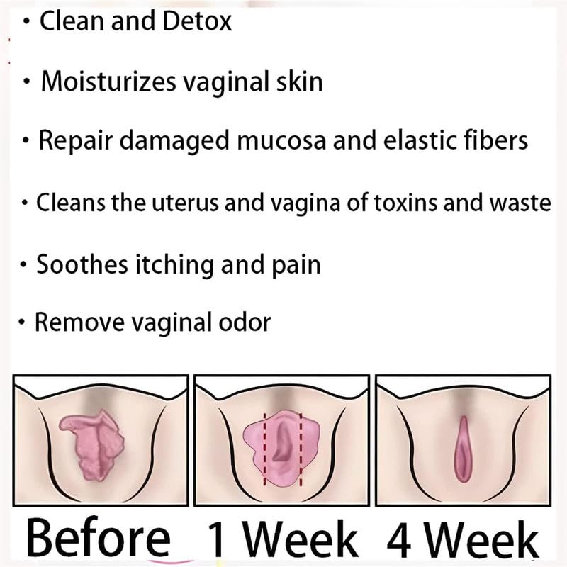 tsoneoo Dexcara Detox Repair - Natural Repair Vagianal Capsules, Natural Repair Vajinal Capsules tsoneooAu supplements