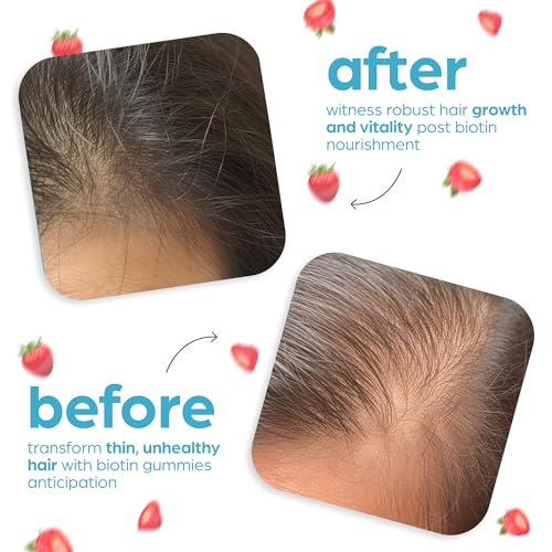 Artnaturals Biotin Gummies for Hair Growth - (100 Gummies - 10000mcg) - Natural Strawberry ArtnaturalsUS supplements