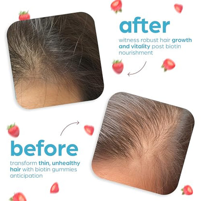 Artnaturals Biotin Gummies for Hair Growth - (100 Gummies - 10000mcg) - Natural Strawberry ArtnaturalsUS supplements