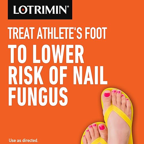 Lotrimin Ultra 1 Week Athlete's Foot Treatment - Antifungal Cream, 30 Gram LotriminUS supplements