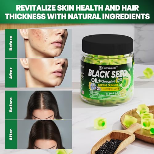 Sugar Free Black Seed Oil Filled Gummies & Chlorophyll, with Hydrolyzed Collagen EnvyCureAu supplements