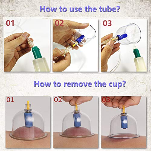 MYMM 12 Cupping Cups Sets Biomagnetic Traditional Professional Chinese Therapy Massage MYMMAu supplements