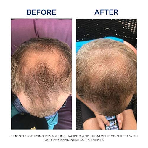 PHYTO Phytophanère 100% Natural Hair Loss Thinning Dietary Supplement PHYTOUS supplements
