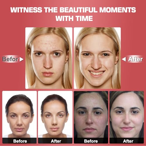 Red Light Therapy M-Ask Red Light Facial M-Ask Red Light Therapy for Face 7-1 Colors Light for Face Home Use LORICKAu supplements