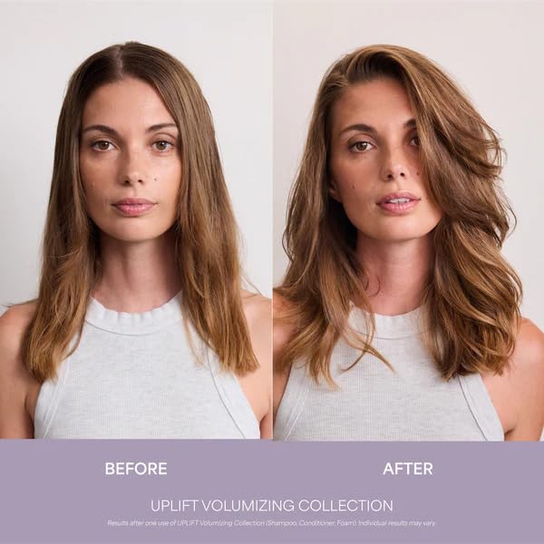 VEGAMOUR UPLIFT and Refresh Kit | Volumizing Dry Shampoo Spray Formulated Without Benzene, Supports Thicker Fuller Looking Hair | $50 Value VEGAMOURAu supplements