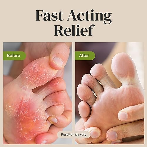 Puriya Tea Tree Oil Antifungal Cream, Plant-Powered Athletes Foot Cream Treatment PuriyaUS supplements