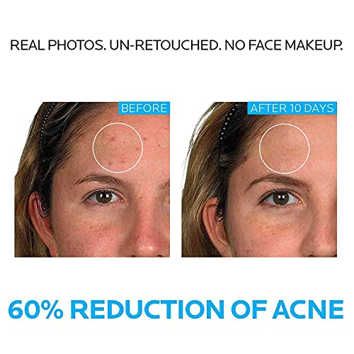 La Roche-Posay Effaclar Dermatological 3 Step Acne Treatment System La Roche-PosayUS supplements