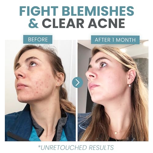 Eva Naturals Vitamin C Face Serum With Hyaluronic Acid - Anti Aging Serum Eva NaturalsAu supplements