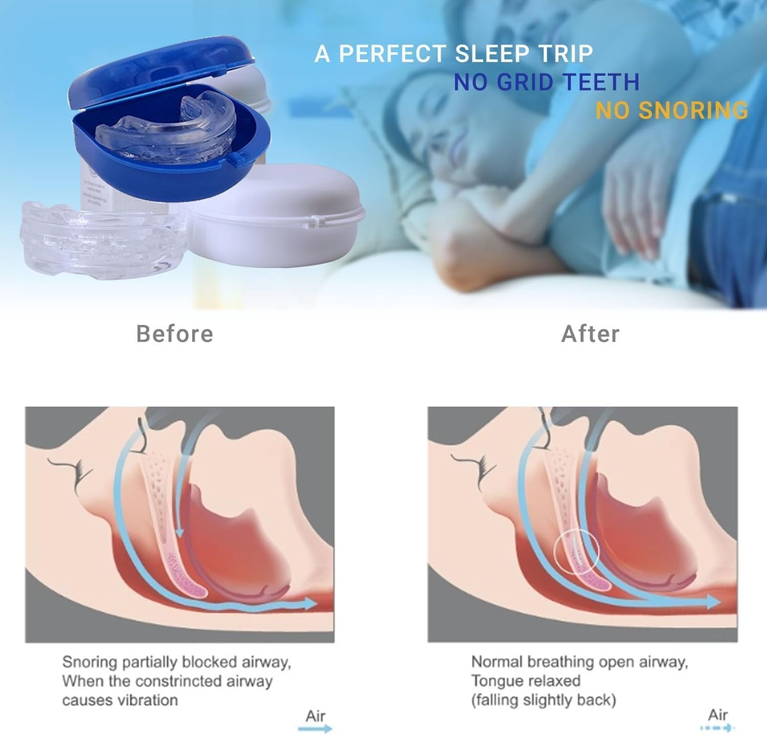 SereneSleep Mouthpiece (Blue) BAWOTYAu supplements
