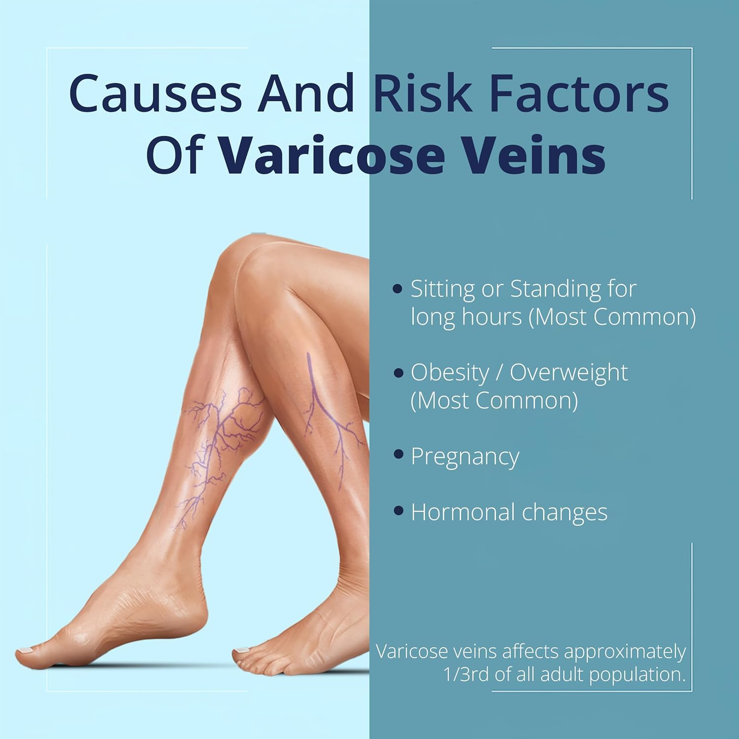 Cream Ayurvedic Solution for Management of Varicose Veins, Spider Veins, Varicocele Helps Reach The Root Cause of varicose Veins Reduces Cramps, Itching & Swelling. Single Tube (25 GMS). GenericAu supplements