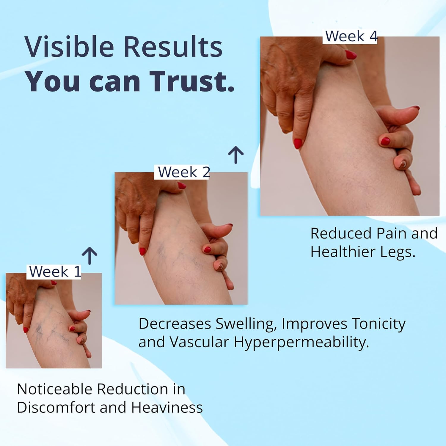 Cream Ayurvedic Solution for Management of Varicose Veins, Spider Veins, Varicocele Helps Reach The Root Cause of varicose Veins Reduces Cramps, Itching & Swelling. Single Tube (25 GMS). GenericAu supplements