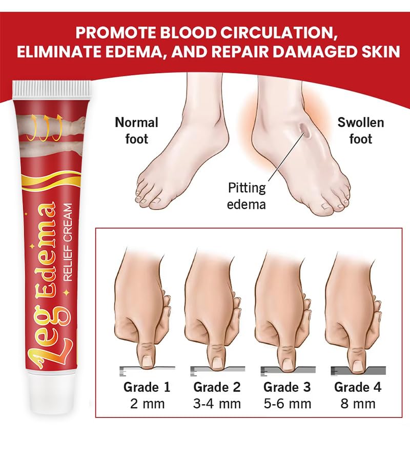 Leg Slimming Massage Cream | Soothing Swelling, Tightening Skin, Auxiliary Care for Reducing Edema （2 Pieces） bobojujuAu supplements